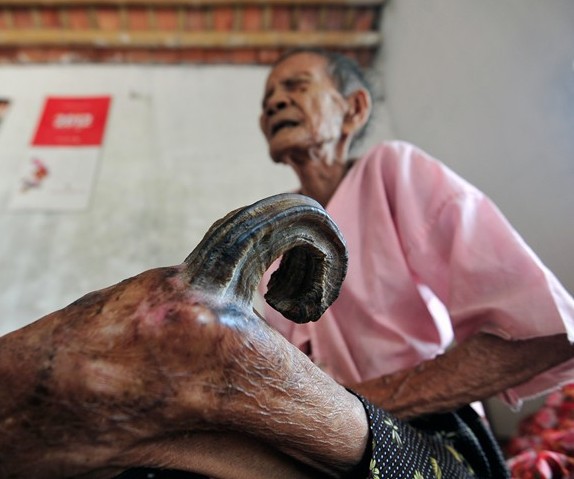 Mô tả ảnh.
