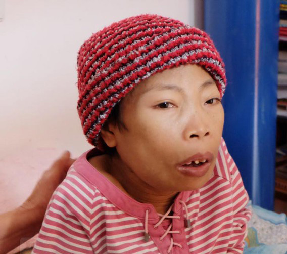Mô tả ảnh.