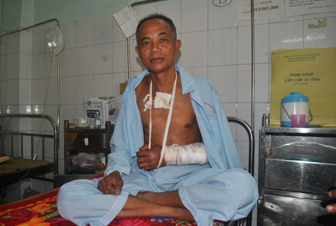 Mô tả ảnh.