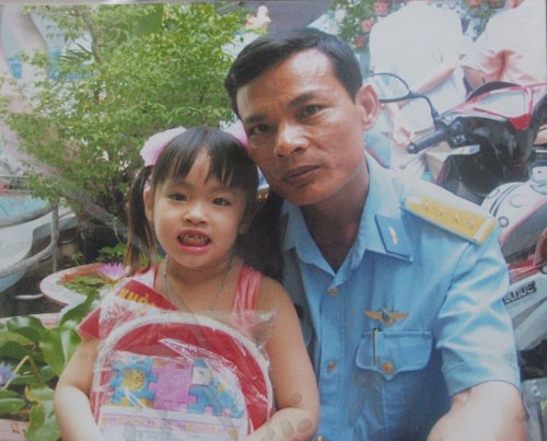 Mô tả ảnh.
