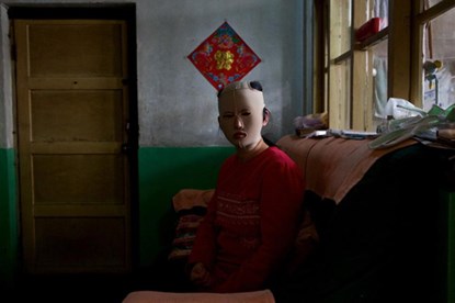 hậu dao kéo.
