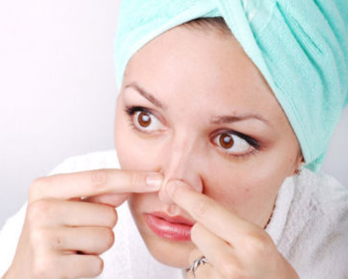 trị mụn trứng cá 
