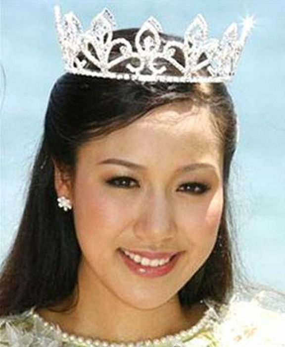Mô tả ảnh.
