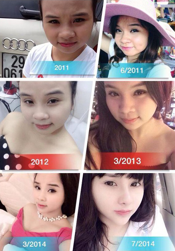 Mô tả ảnh.