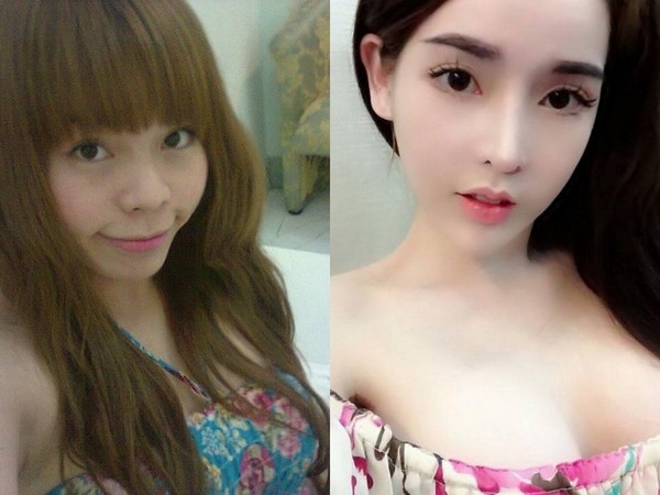 Mô tả ảnh.