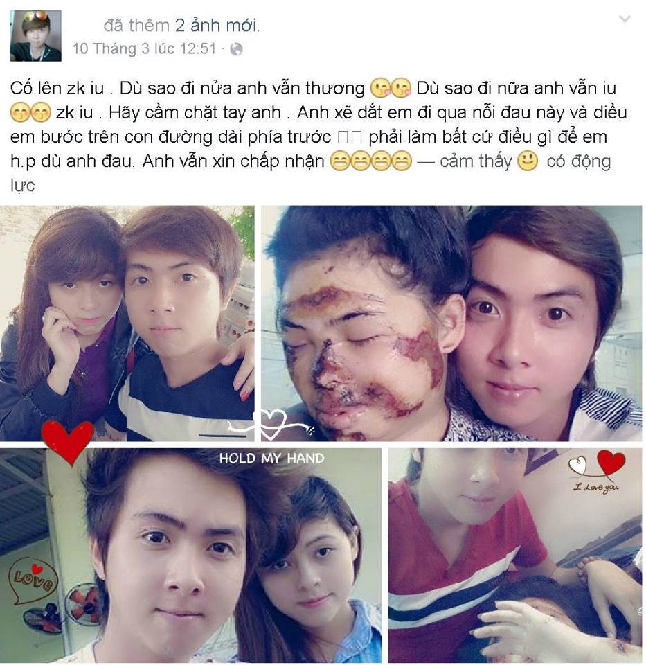 Mô tả ảnh.