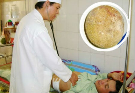 Mô tả ảnh.