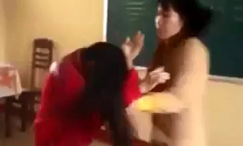 Mô tả ảnh.