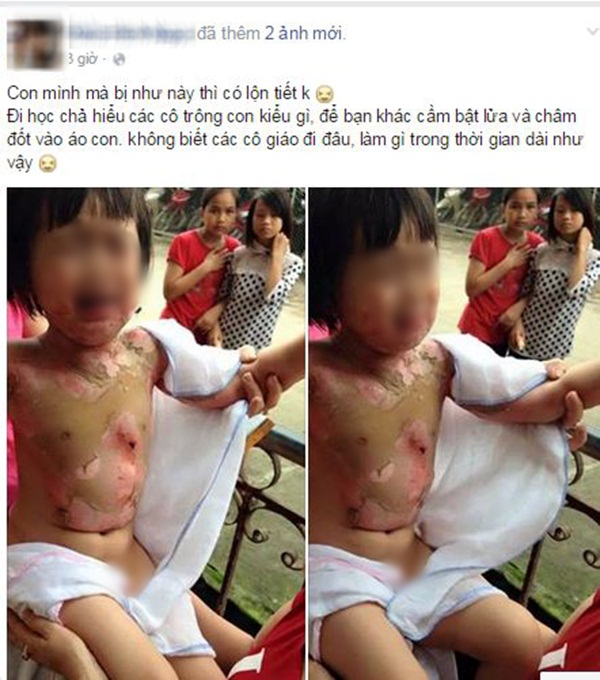 Mô tả ảnh.