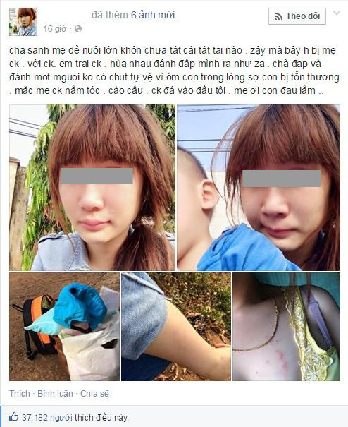Mô tả ảnh.