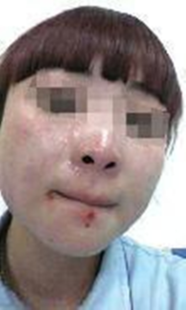 Mô tả ảnh.