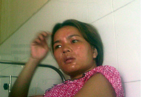 Mô tả ảnh.