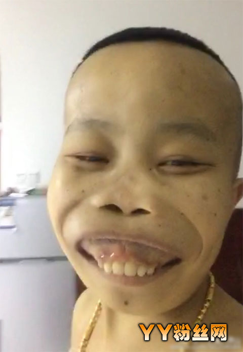 xau