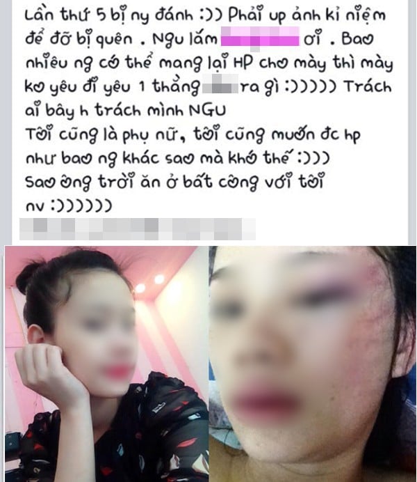 Mô tả ảnh.
