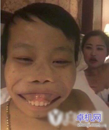 Mô tả ảnh.