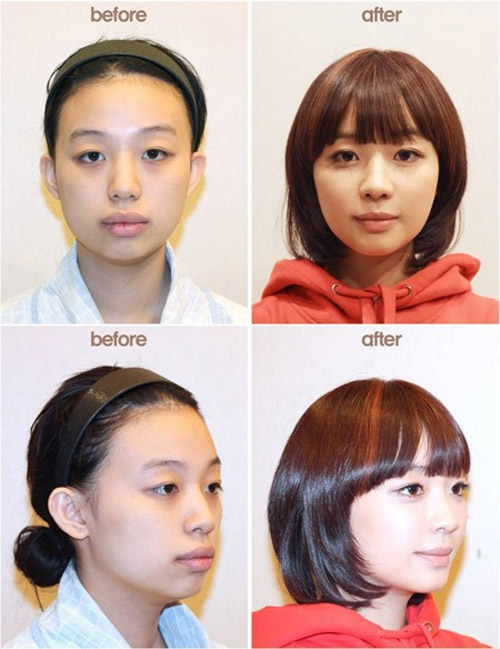 hoá mỹ nhân nhờ thẩm mỹ 