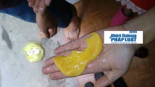 Mô tả ảnh.