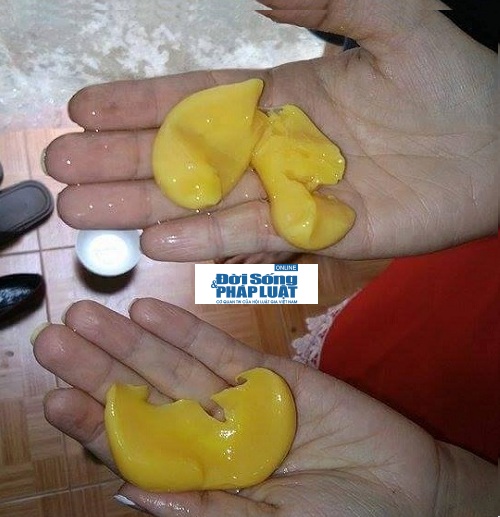 Mô tả ảnh.