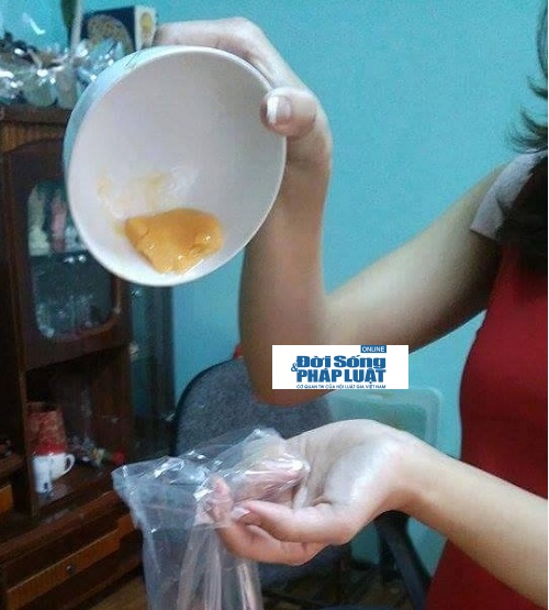 Mô tả ảnh.