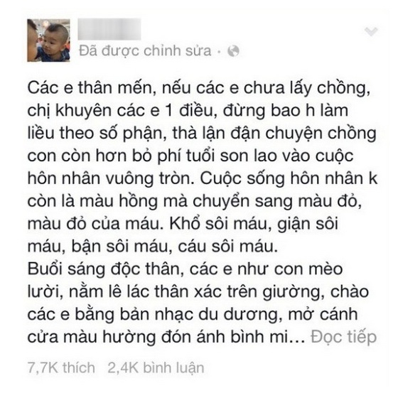 Mô tả ảnh.