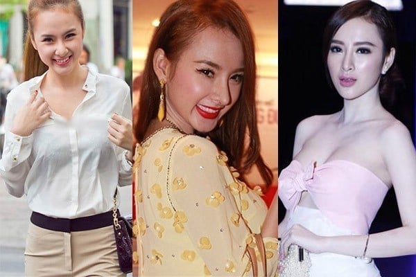 angela phương trinh sửa mũi