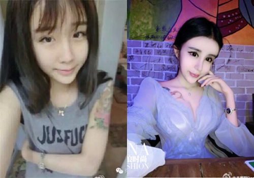 sao châu á thẩm mỹ 