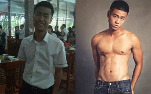thẩm mỹ vì bị người yêu bỏ