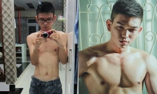 thẩm mỹ vì bị người yêu bỏ