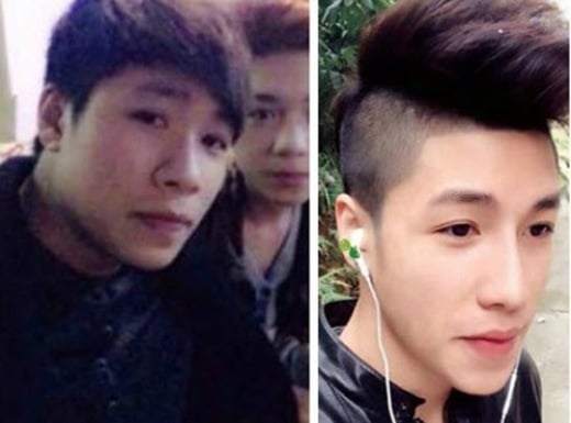 thẩm mỹ vì bị người yêu bỏ