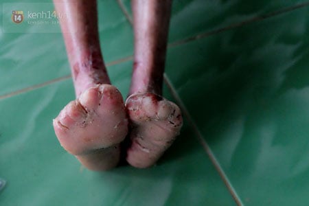 Mô tả ảnh.