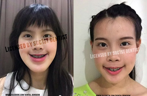Shbet888 tiền thưởng cực khủng thẩm mỹ 
