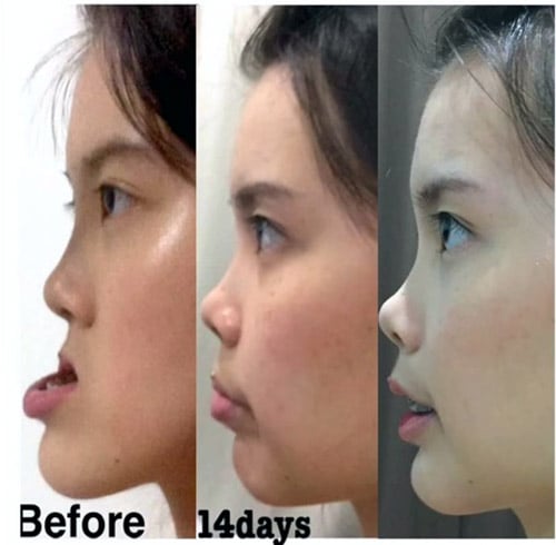 Shbet888 tiền thưởng cực khủng thẩm mỹ 