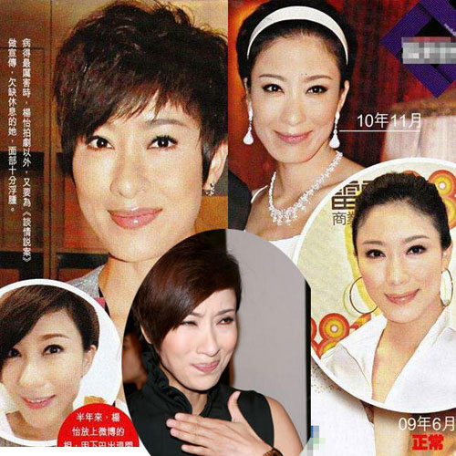 sao Shbet888 tiền thưởng cực khủng thẩm mỹ 