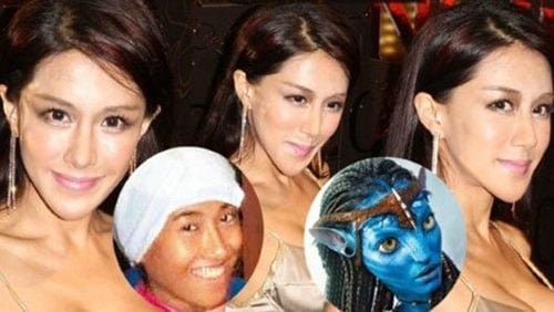 sao Shbet888 tiền thưởng cực khủng thẩm mỹ 