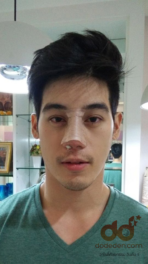xe ôm thẩm mỹ
