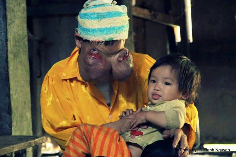 Mô tả ảnh.