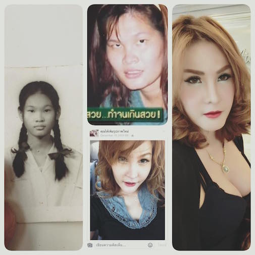 thẩm mỹ