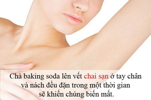 Mô tả ảnh.
