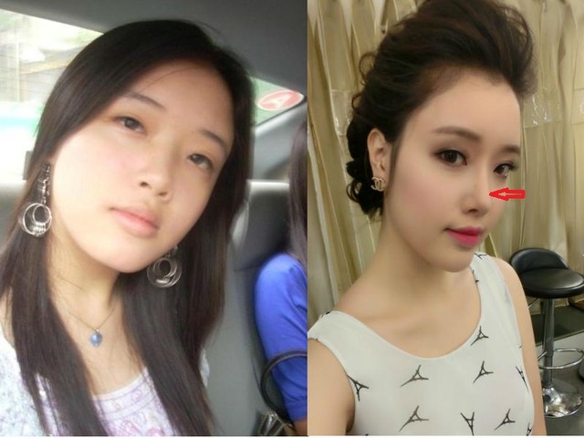 Xinh đẹp bất ngờ, em gái Mai Phương Thúy bị nghi dao kéo