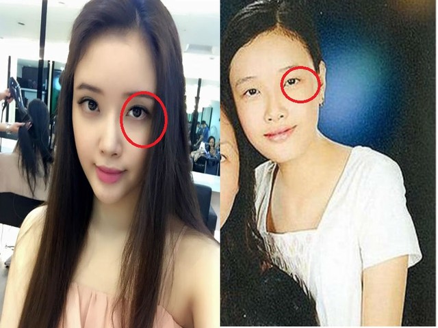 Xinh đẹp bất ngờ, em gái Mai Phương Thúy bị nghi dao kéo