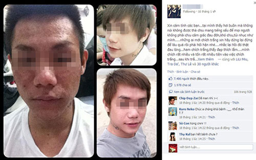 thảm kịch tắm trắng