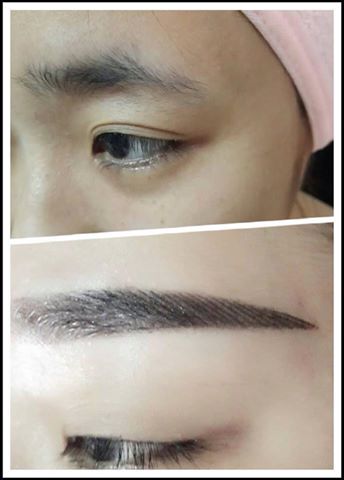 làm đẹp nguy hiểm 