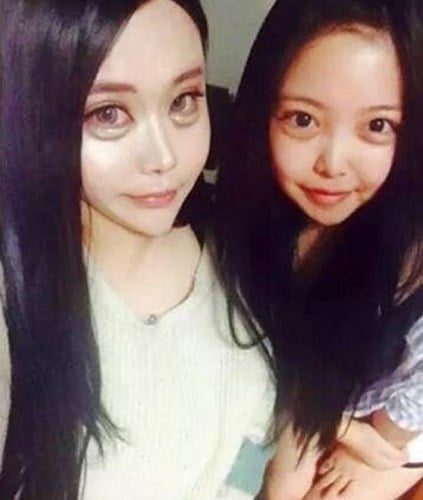 thẩm mỹ tạo bọng mắt 