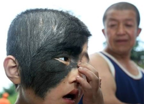 Mô tả ảnh.
