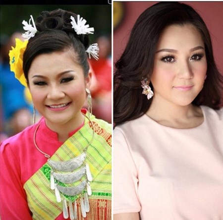 tiêm chất  màu trắng