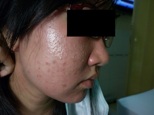 myc phẩm rởm