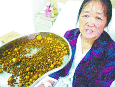 Mô tả ảnh.