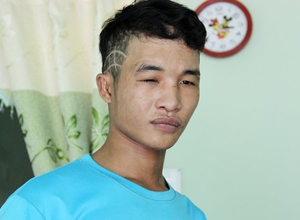 Mô tả ảnh.