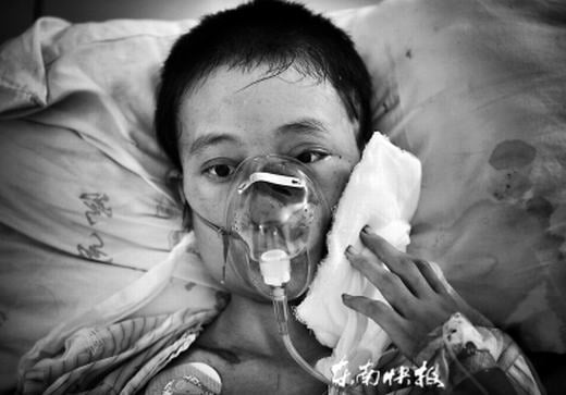 tử vong vì giòi ký sinh