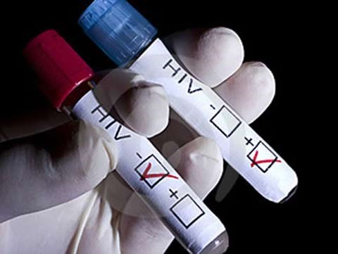 nhiễm hiv